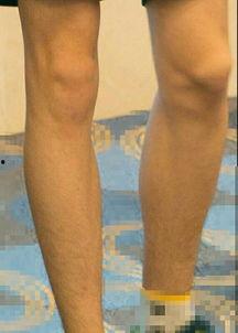 腿毛多的男生照片,彰显男性魅力与自信  第2张